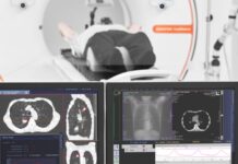 El Hospital Marcial Quiroga lanzó un programa gratuito de detección temprana de cáncer de pulmón